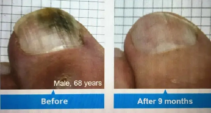 Looking for a Room to Rent for Foot Care Services – North London
