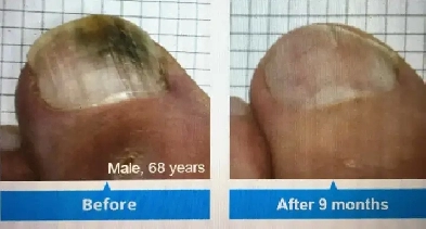 Looking for a Room to Rent for Foot Care Services – North London